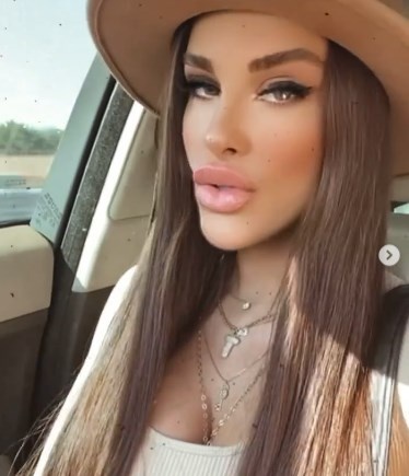 Adanalı’nın Pınar’ı estetiğin dozunu kaçırdı!