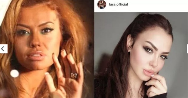 #20'liyaschallenge akımı ile estetikli güzeller ortaya çıktı