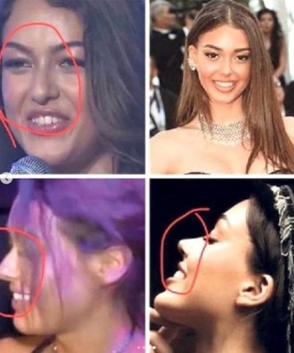 #20'liyaschallenge akımı ile estetikli güzeller ortaya çıktı