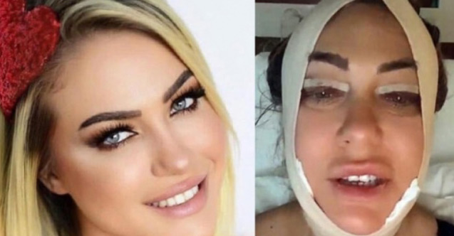 Ünlü oyuncu bıçak altına yattı