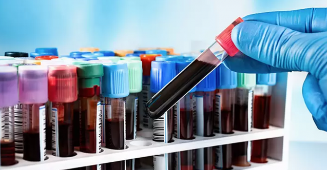 Bilim Kurgu gerçek oldu: Basit bir kan testiyle ömrünüz tahmin edilebilecek