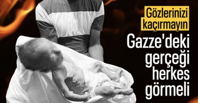 Gazze'de bir bebek daha açlıktan öldü