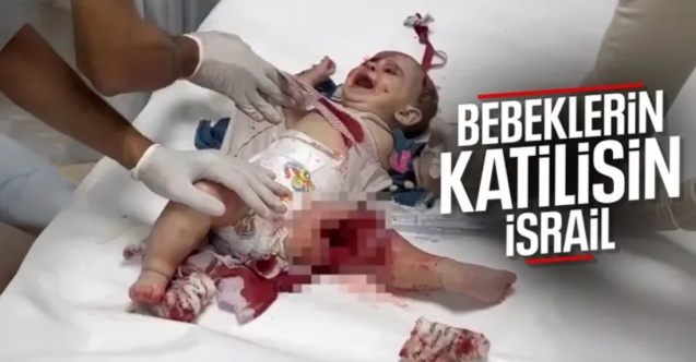 İsrail, Gazze'de bebekleri hedef alıyor