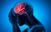 Bu 3 hastalık beyninizi yaşlandırıyor
