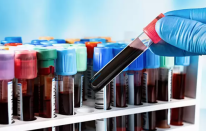 Bilim Kurgu gerçek oldu: Basit bir kan testiyle ömrünüz tahmin edilebilecek