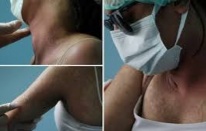 Van'da internetten aldığı krem hastanelik etti