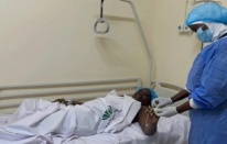 'Lassa ateşi’ salgını: 166 kişi hayatını kaybetti