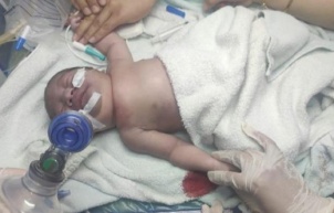 Bir hastanede çıkan yangında yeni doğan 11 bebek öldü