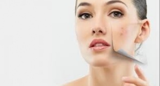 Cilt Lekeleri İçin Güzellik Sırları