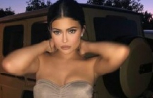 Kaza geçiren makyözü için bağış toplanmasını istedi!