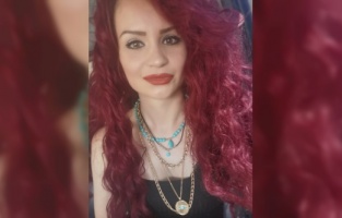 Tedavi sonrası yüzünde yanıklar oluşan kadın şikayetçi oldu