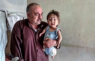 Fatıma bebek anne karnındayken Esad rejiminin kimyasal silahlarının kurbanı oldu