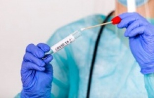 15 ülkeden gelen yolculardan PCR testi istenmeyecek