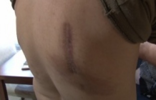 Sultanbeyli'de şiddetli öksürük şikayetiyle hastaneye gitti, kaburgalarının kırıldığını öğrendi