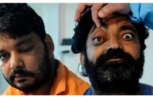 Covid-19’dan sonra yeni tehlike Kara Mantar