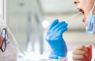 Kritik süreç devam ediyor! Vakalar düne göre arttı