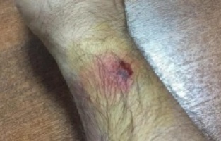 Paraları toplayan komiserin kolunu ısırdı