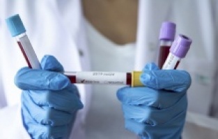 Vaka sayısı 20 bini aştı