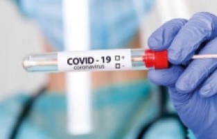 Son 24 saatte korona virüsten 183 kişi hayatını kaybetti