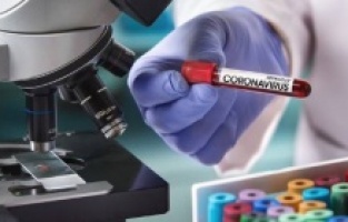 Son 24 saatte korona virüsten 91 kişi hayatını kaybetti