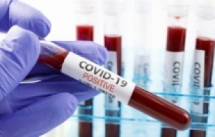 Vaka sayısı 26 bini aştı