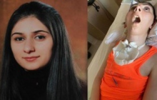 Estetik ameliyatı hayatını kararttı