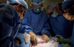 Herkes bu ameliyatı bekliyordu!