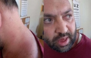 Aile hekimine çirkin saldırı! İstediği ilacı yazmadı diye...