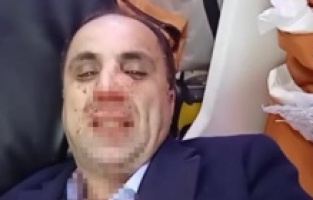 Diyarbakır Berberler, Kuaförler ve Güzellik Uzmanları Esnaf Odası başkanlık seçiminde kavga