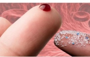 Her 22 kişiden 17’sinin kanında mikroplastik parçacıklar var