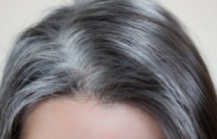 Saçınız beyazlıyorsa aman dikkat! Hangi vitamin eksikliğiniz var?