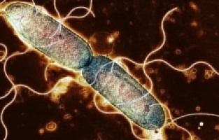 ABD'de Salmonella nedeniyle toplatılan Jif Fıstık Kremaları Türkiye'deki raflarda tespit edildi