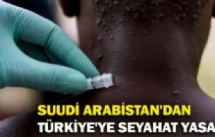 Hastalığın 6 önemli belirtisi var! Maymun çiçeği hızla yayılıyor, tecrit kararı alan ülke bile var