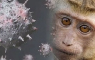 Maymun çiçeği virüsü Türkiye'de var mı, açıklama geldi mi?