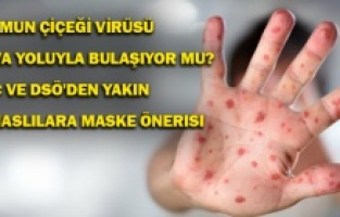 Maymun çiçeği virüsü hava yoluyla bulaşıyor mu? CDC ve DSÖ'den yakın temaslılara maske önerisi