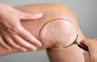 Yaz aylarında sık görülen beş enfeksiyon!!!!