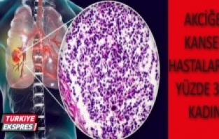 Araştırma: Akciğer kanseri hastaların yüzde 34’ü kadın